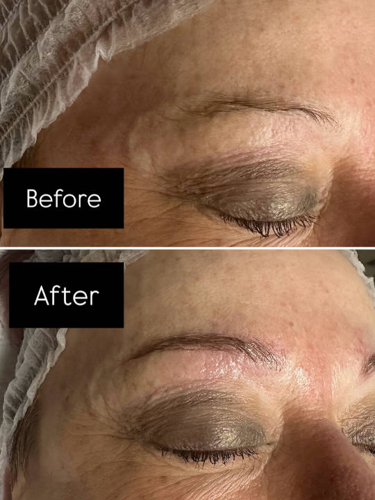 Precision Hair Skin Brow Treatments